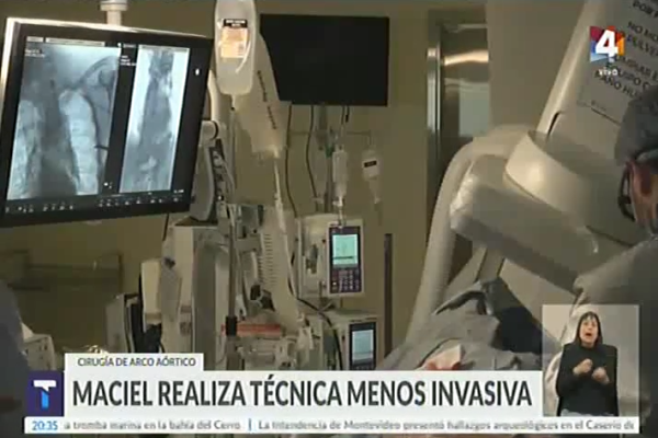 Canal 4 y Canal 12: Cirugías complejas menos invasivas