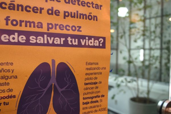 Radio Universal: ASSE convoca a usuarios para plan piloto que busca detectar cáncer de pulmón de forma precoz